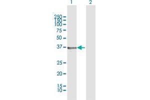 Western Blotting (WB) image for anti-Hydroxysteroid (17-Beta) Dehydrogenase 2 (HSD17B2) (AA 1-387) antibody (ABIN516715)