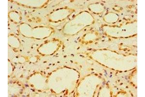 Immunohistochemistry of paraffin-embedded human kidney tissue using ABIN7150785 at dilution of 1:100 (DUSP7 抗体  (AA 160-419))
