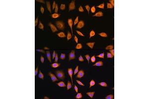 Immunofluorescence (IF) image for anti-Sterol O-Acyltransferase 1 (SOAT1) (AA 1-130) antibody (ABIN6148259)
