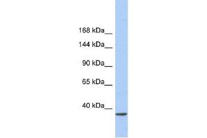 WB Suggested Anti-SMARCAD1 Antibody Titration:  0. (SMARCAD1 抗体  (N-Term))