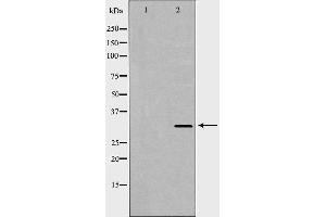 Western blot analysis of Hepg2 whole cell lysates, using HAVCR2 Antibody.