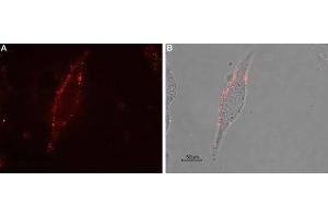 Expression of μ-opioid receptor (MOR-1) in rat C6 cells - Cell surface detection of μ-opioid receptor (MOR-1) in intact living rat brain glioma (C6) cells.