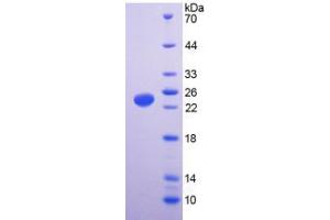 SDS-PAGE analysis of Human TRPV1 Protein. (TRPV1 蛋白)