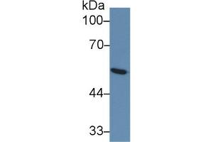 Detection of GLUT1 in Human Serum using Monoclonal Antibody to Glucose Transporter 1 (GLUT1) (GLUT1 抗体  (AA 251-329))