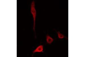 ABIN6274779 staining HepG2 cells by IF/ICC. (RPL34 抗体)