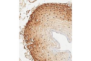 Immunohistochemical analysis of paraffin-embedded Human esophagus tissue using (ABIN6243695 and ABIN6578909) performed on the Leica® BOND RXm. (HSP70 1A 抗体)