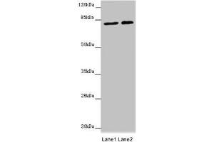 Western blot All lanes: DHX33 antibody at 16 μg/mL Lane 1: Hela whole cell lysate Lane 2: 293T whole cell lysate Secondary Goat polyclonal to rabbit IgG at 1/10000 dilution Predicted band size: 79, 61 kDa Observed band size: 79 kDa (DHX33 抗体  (AA 116-357))