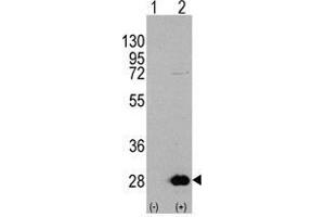 Western blot analysis of HSPB1 (arrow) using rabbit polyclonal HSPB1 Antibody 293 cell lysates (2 µg/lane) either nontransfected (Lane 1) or transiently transfected with the HSPB1 gene (Lane 2) (HSP27 抗体  (Ser78))