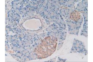 IHC-P analysis of Rat Pancreas Tissue, with DAB staining. (MAP4 抗体  (AA 2-250))