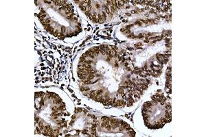 Immunohistochemistry (IHC) image for anti-Aryl Hydrocarbon Receptor (AHR) (AA 619-848) antibody (ABIN5663909)