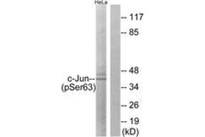 Western blot analysis of extracts from HeLa cells treated with UV, using c-Jun (Phospho-Ser63) Antibody. (C-JUN 抗体  (AA 31-80))