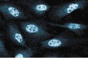 Immunofluorescence staining of human endothelial cells. (RAD50 抗体  (AA 672-786))