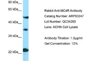 Western Blotting (WB) image for anti-Melanocortin 4 Receptor (MC4R) (N-Term) antibody (ABIN2789422) (MC4R 抗体  (N-Term))