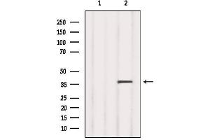 Western blot analysis of extracts from 293, using RLBP1 Antibody. (RLBP1 抗体  (Internal Region))