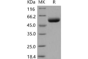 Western Blotting (WB) image for ST6 beta-Galactosamide alpha-2,6-Sialyltranferase 1 (ST6GAL1) (Active) protein (His tag) (ABIN7320160) (ST6GAL1 Protein (His tag))