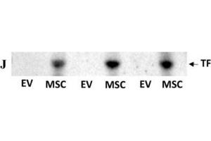 Analysis of phosphatidylserine and tissue factor (TF) expression on MSC and EV surface and the role of phosphatidylserine in procoagulation effects.