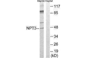Western blot analysis of extracts from HepG2 cells, using SLC17A2 antibody. (SLC17A2 抗体  (Internal Region))