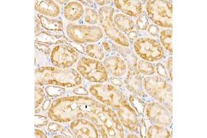 Immunohistochemistry of paraffin-embedded rat kidney using G Rabbit pAb (ABIN6133219, ABIN6140940, ABIN6140941 and ABIN6222644) at dilution of 1:450 (40x lens). (GALNT2 抗体  (AA 442-571))