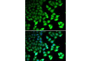 Immunofluorescence analysis of U2OS cells using KDM4B antibody (ABIN5973438). (KDM4B 抗体)