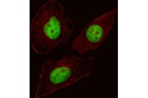 Fluorescent image of Hela cell stained with FOXN3 Antibody (C-term) (ABIN1537230 and ABIN2838260). (FOXN3 抗体  (C-Term))