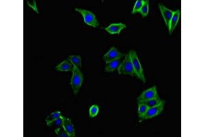 Immunofluorescent analysis of HepG2 cells using ABIN7175380 at dilution of 1:100 and Alexa Fluor 488-congugated AffiniPure Goat Anti-Rabbit IgG(H+L) (FLT1 抗体  (AA 1048-1328))