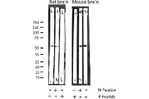 Western blot analysis of Phospho-CaMK2 alpha/ beta/ delta (Thr305) expression in various lysates (CaMK2 alpha/beta/delta 抗体  (pThr305))