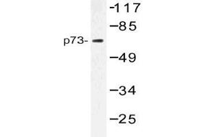 Western blot (WB) analysis of p73 antibody in extracts from Jurkat cells.