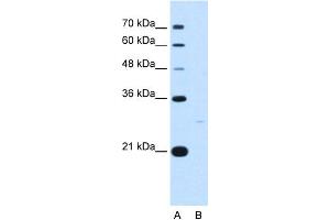 WB Suggested Anti-YWHAZ Antibody Titration:  5. (14-3-3 zeta 抗体  (C-Term))