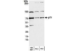 Western Blotting (WB) image for anti-Tumor Protein P73 (TP73) (AA 1-62) antibody (ABIN7450533)