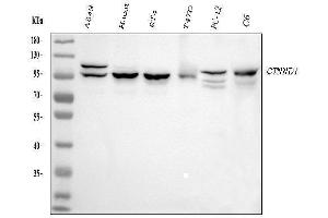 Western blot analysis of CTNND1 using anti-CTNND1 antibody (ABIN7602220).
