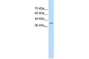 WB Suggested Anti-SERPINB5 Antibody Titration:  0. (SERPINB5 抗体  (Middle Region))
