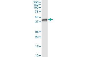 Immunoprecipitation of NSDHL transfected lysate using anti-NSDHL MaxPab rabbit polyclonal antibody and Protein A Magnetic Bead , and immunoblotted with NSDHL purified MaxPab mouse polyclonal antibody (B01P) . (NSDHL 抗体  (AA 1-373))