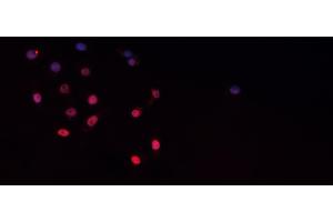 Immunofluorescence (fixed cells) (IF/ICC) image for anti-CCAAT/enhancer Binding Protein (C/EBP), beta (CEBPB) (pThr235) antibody (ABIN6256518)