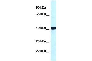 PRKACB antibody used at 1 ug/ml to detect target protein. (PRKACB 抗体  (Middle Region))