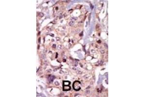 Immunohistochemistry (IHC) image for anti-Nuclear Receptor Subfamily 4, Group A, Member 3 (NR4A3) antibody (ABIN3003456) (NR4A3 抗体)