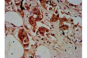 Immunohistochemistry (IHC) image for anti-Signal Sequence Receptor, beta (Translocon-Associated Protein Beta) (SSR2) (AA 18-149) antibody (ABIN7172918)