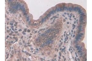DAB staining on IHC-P; Samples: Mouse Liver Tissue (SNX18 抗体  (AA 411-614))