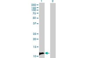 Western Blot analysis of TANK expression in transfected 293T cell line by TANK MaxPab polyclonal antibody. (TANK 抗体  (AA 1-119))