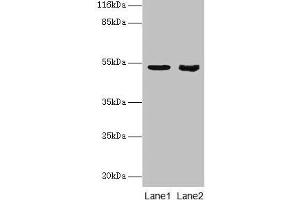 Western blot All lanes: SKP2 antibody at 2 μg/mL Lane 1: Jurkat whole cell lysate Lane 2: Hela whole cell lysate Secondary Goat polyclonal to rabbit IgG at 1/10000 dilution Predicted band size: 48, 47, 24 kDa Observed band size: 48 kDa (SKP2 抗体  (AA 1-424))