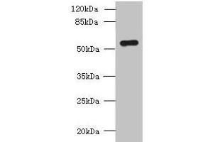 Western blot All lanes: SLC38A2 antibody at 1. (SLC38A2 抗体  (AA 1-76))