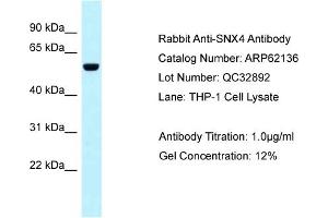Western Blotting (WB) image for anti-Sorting Nexin 4 (SNX4) (C-Term) antibody (ABIN2789032) (Sorting Nexin 4 抗体  (C-Term))