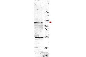 Image no. 1 for anti-Neural Precursor Cell Expressed, Developmentally Down-Regulated 4, E3 Ubiquitin Protein Ligase (NEDD4) (Internal Region) antibody (ABIN401453) (NEDD4 抗体  (Internal Region))
