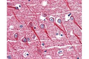 Anti-TNFR1 antibody IHC of human brain, cortex.