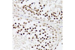 Immunohistochemistry of paraffin-embedded Rat testis using EP300 antibody (ABIN6127823, ABIN6140193, ABIN6140194 and ABIN6216844) at dilution of 1:100 (40x lens).