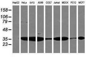Image no. 3 for anti-Proteasome Subunit alpha 4 (PSMA4) antibody (ABIN1500458) (PSMA4 抗体)