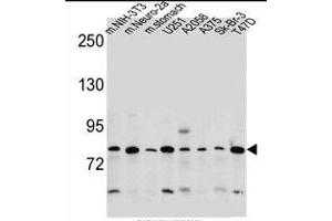 DCBLD2 Antibody (C-term) (ABIN657748 and ABIN2846732) western blot analysis in mouse NIH-3T3,Neuro-2a cell line and mouse stomach tissue and ,,,Sk-Br-3,T47D cell line lysates (35 μg/lane). (DCBLD2 抗体  (C-Term))