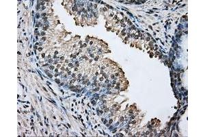 Immunohistochemical staining of paraffin-embedded prostate tissue using anti-ARNT mouse monoclonal antibody. (ARNT 抗体)