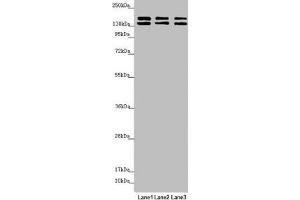 Western blot All lanes: UACA antibody at 5. (UACA 抗体  (AA 1-90))