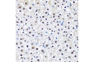 Immunohistochemistry of paraffin-embedded mouse liver using CCAR2 antibody (ABIN2563550) at dilution of 1:100 (40x lens). (CCAR2 抗体)