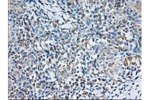 Immunohistochemical staining of paraffin-embedded Human Kidney tissue using anti-TTC32 mouse monoclonal antibody. (TTC32 抗体)